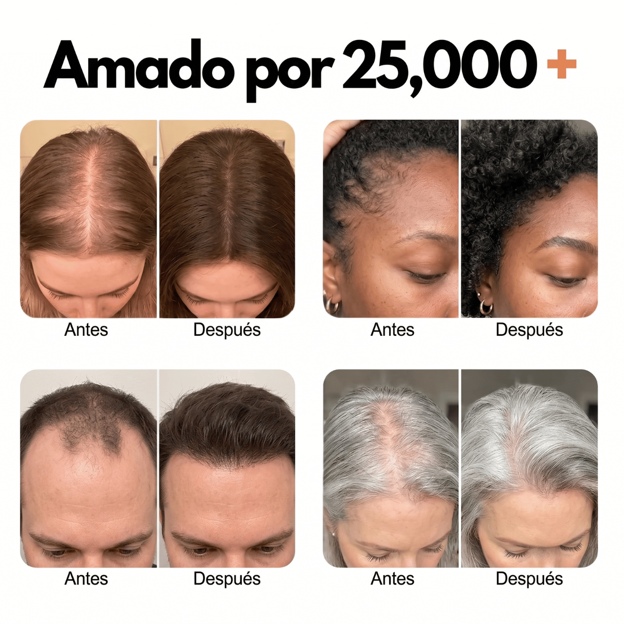 Virea | Suero para el crecimiento del cabello