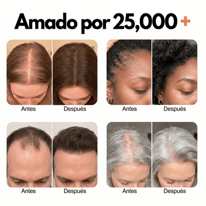 Virea | Suero para el crecimiento del cabello