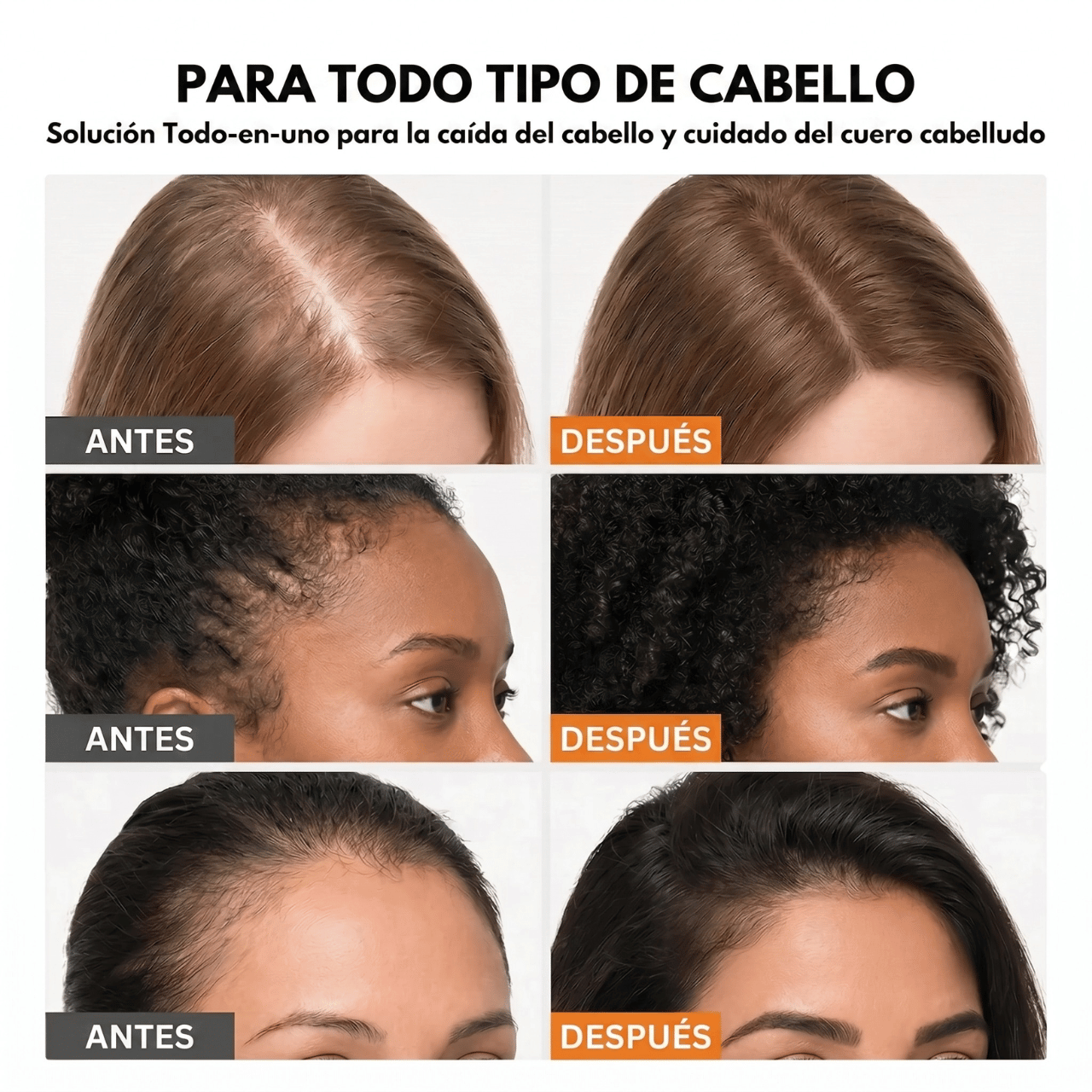 Virea | Suero para el crecimiento del cabello