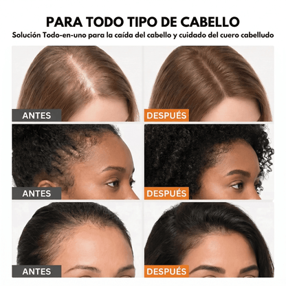 Virea | Suero para el crecimiento del cabello